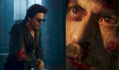 शूटिंग के दौरान शाहरुख खान का एक्सीडेंट, फैंस परेशान