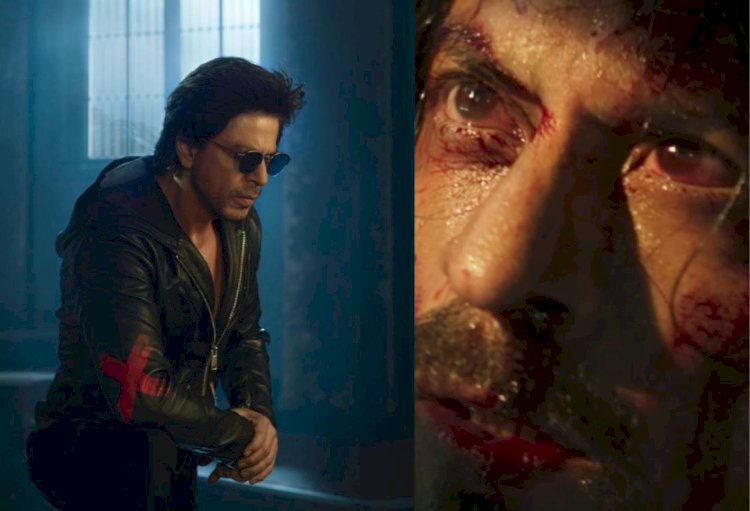 शूटिंग के दौरान शाहरुख खान का एक्सीडेंट, फैंस परेशान