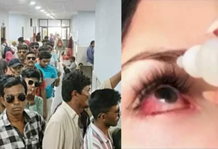 राजस्थान सरकार अलर्ट मोड पर, गाइडलाइन जारी, जानें लक्षण और बचाव