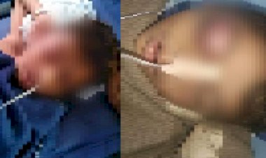 जालौर में बालक की मौत के आरोपी शिक्षक छैलसिंह को जमानत