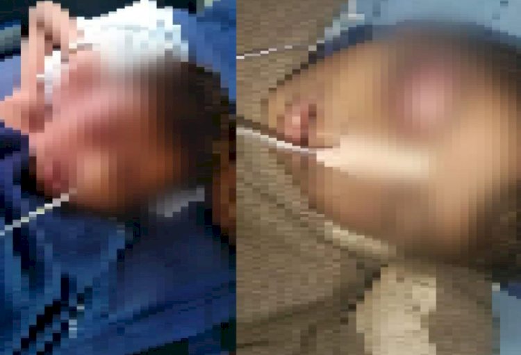 जालौर में बालक की मौत के आरोपी शिक्षक छैलसिंह को जमानत