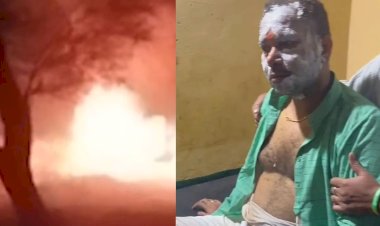 चुनाव में जनता का समर्थन और जीत पाने के लिए प्रत्याशी ने खुद को आग लगाई
