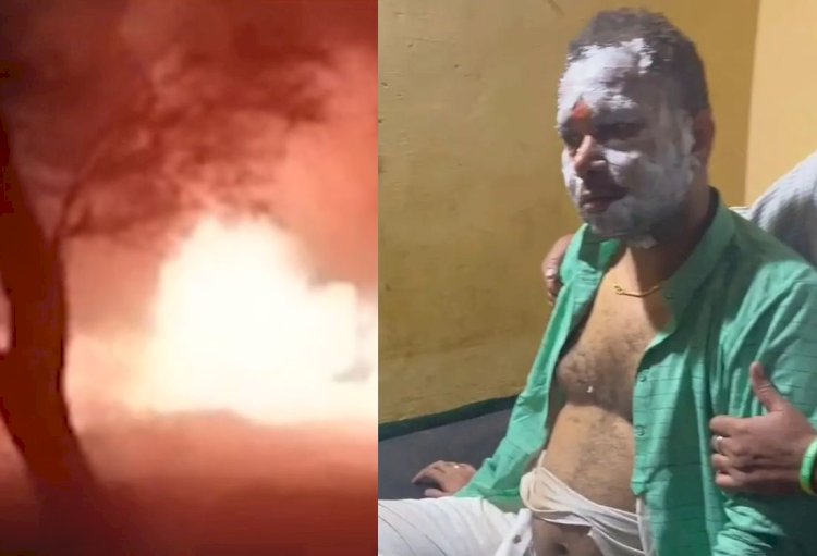 चुनाव में जनता का समर्थन और जीत पाने के लिए प्रत्याशी ने खुद को आग लगाई