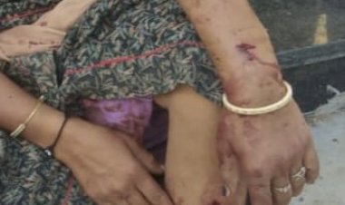 बलात्कार की रिपोर्ट दर्ज करवाई तो ,अपराधी ने किया परिवार पर किया जानलेवा हमला