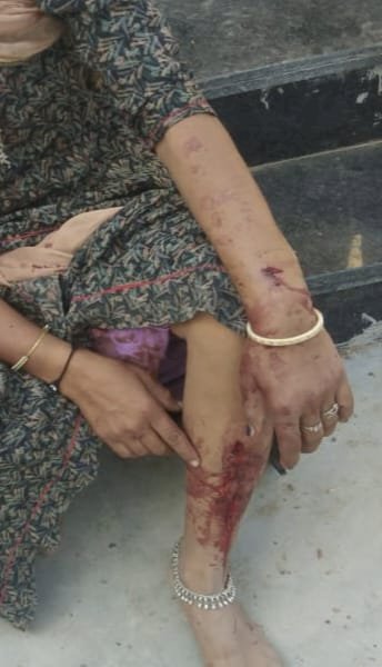 बलात्कार की रिपोर्ट दर्ज करवाई तो ,अपराधी ने किया परिवार पर किया जानलेवा हमला