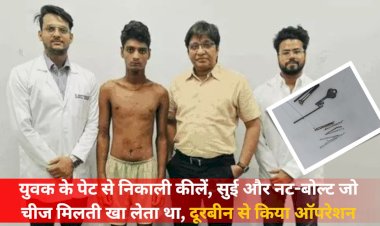 दूरबीन से ऑपरेशन कर युवक के पेट से निकाली कीले, नट-बोल्ट और सुई, जो मिलता वो खा लेता था,घरवालों ने दर्द होने पर करवाई जाँच
